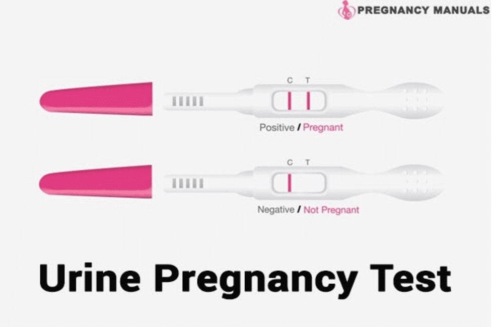 How Long Can You Keep Your Urine For A Pregnancy Test?