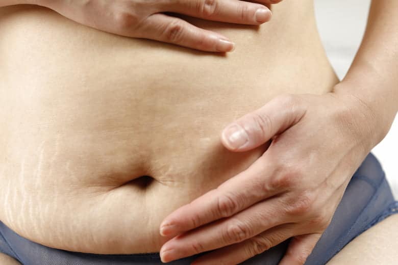 How To Tighten Loose Skin On Stomach After Pregnancy?